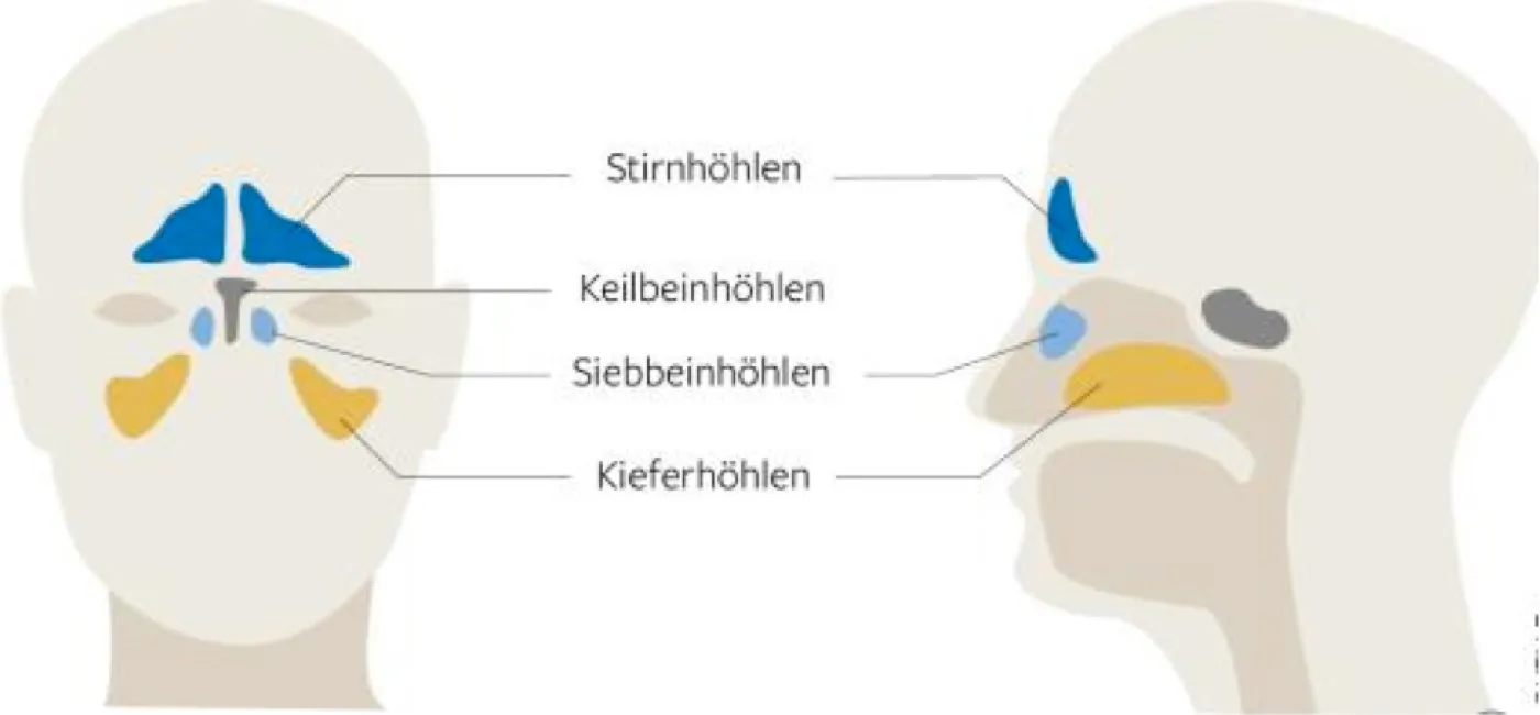 Schema eines Kopfes von vorne und von der Seite mit farbig markierten Stirn-, Keilbein-, Siebbein- und Kieferhöhlen